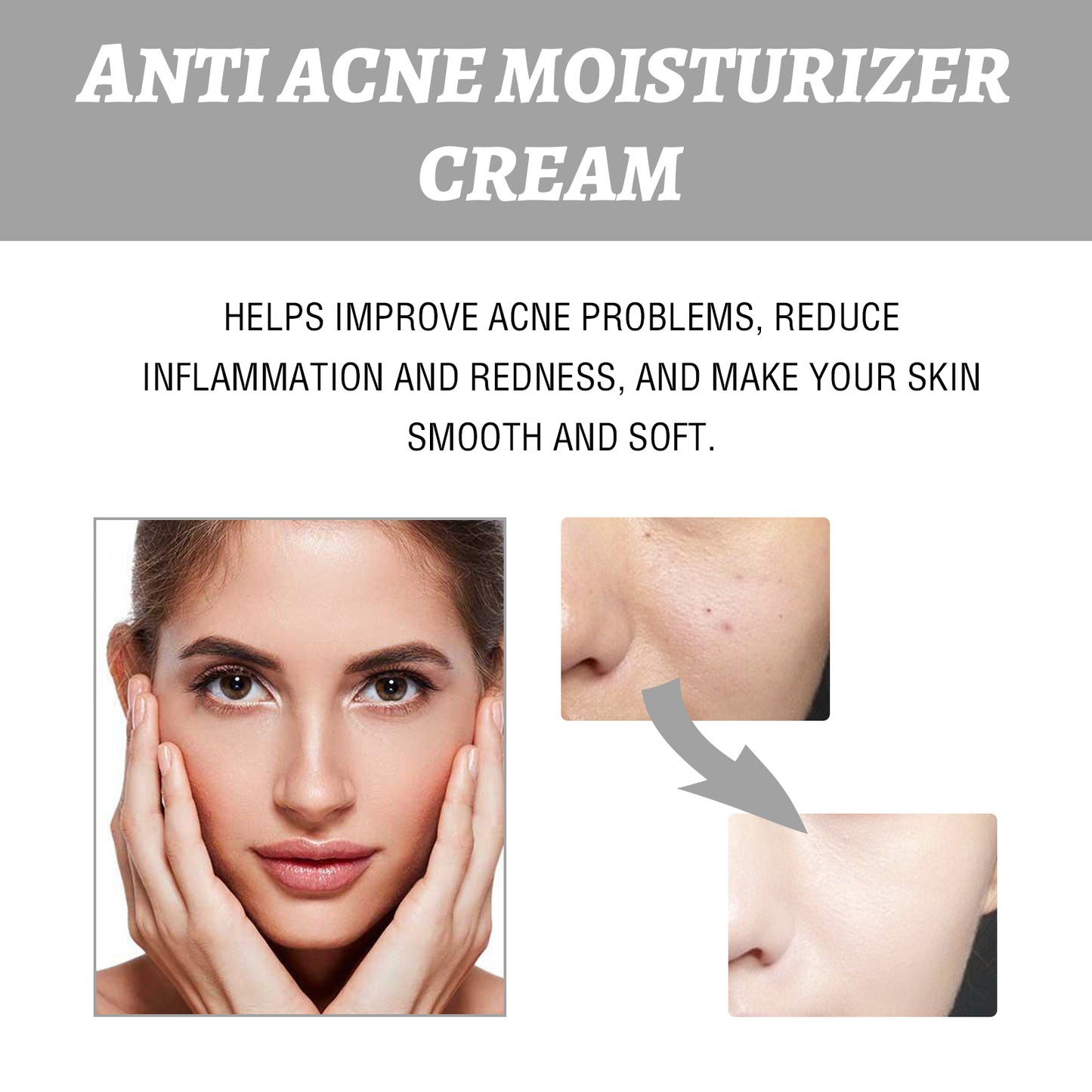 Hydrating Cream and Lightening Facial Acne Repair Redness Brightening Moisturizing Cream