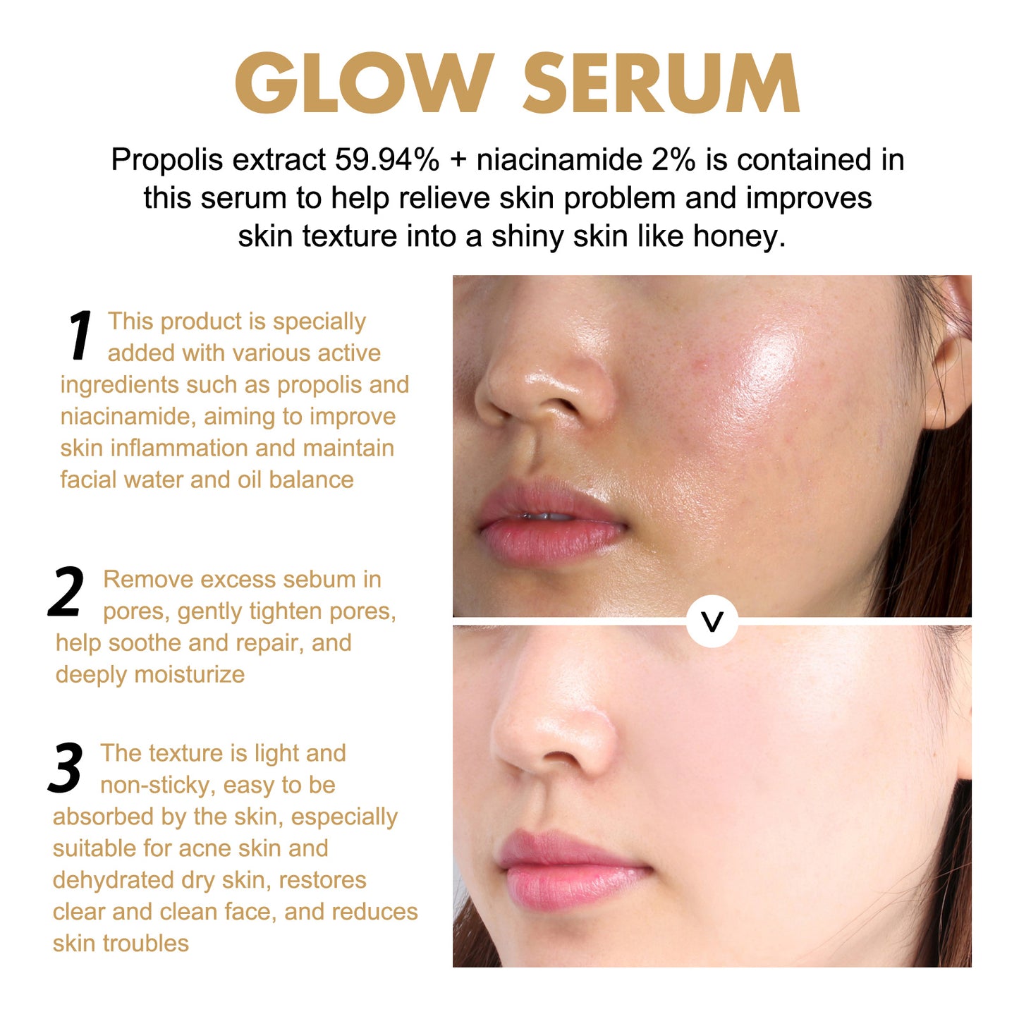 Propolis & Nicotinamide Brightening Essence – Fades Acne Marks