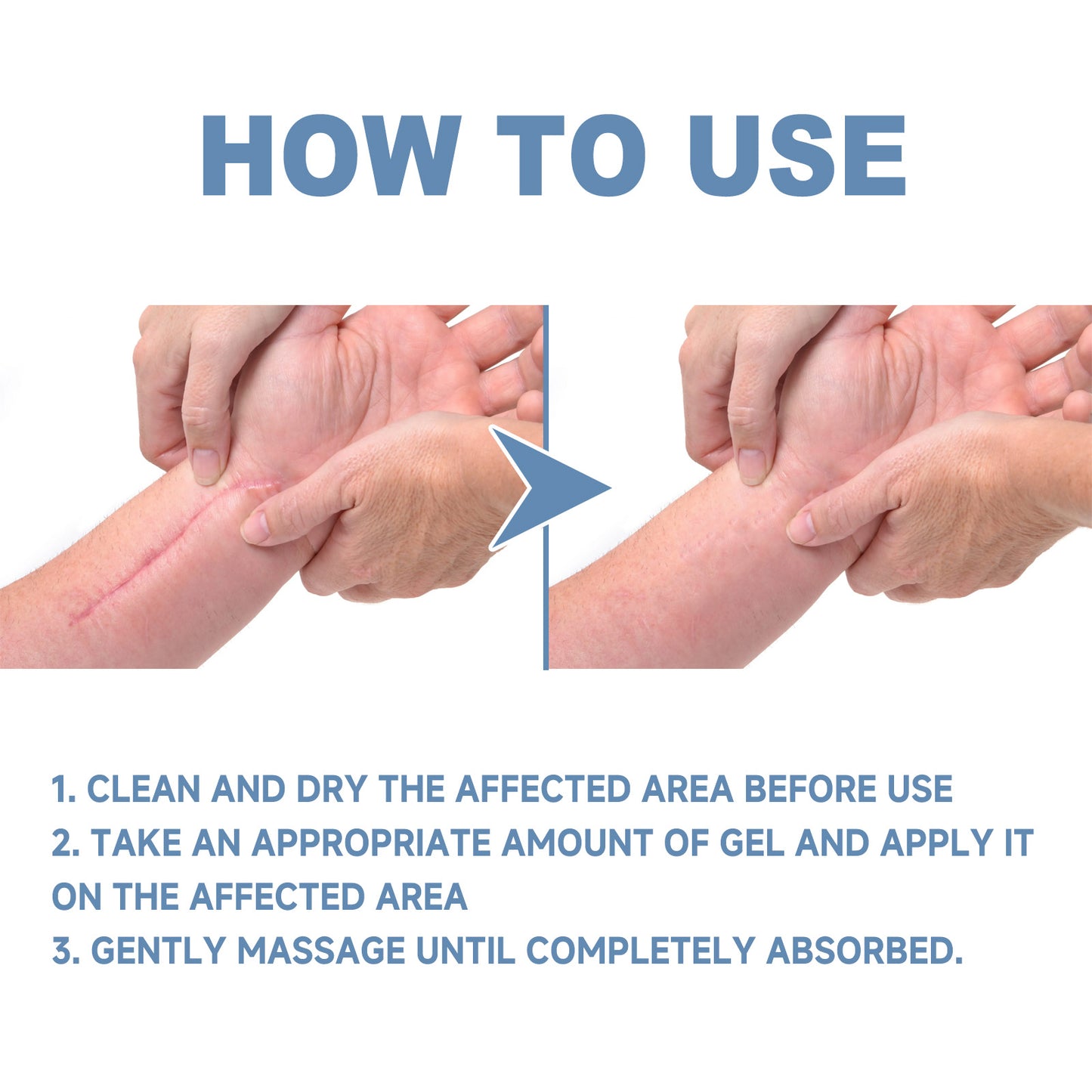 Scar Repair & Whitening Gel – Moisturizing Treatment for Surgery Scars