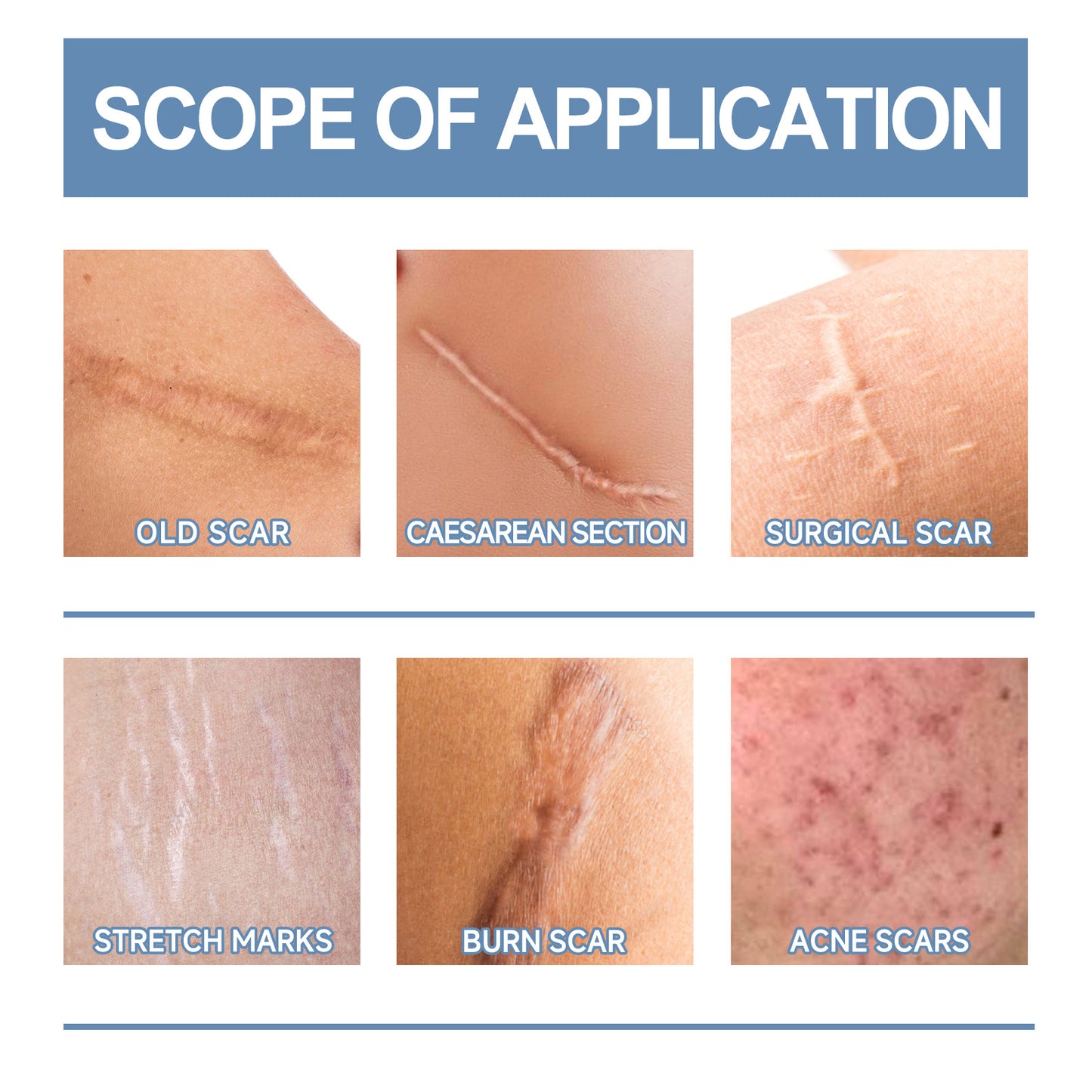 Scar Repair & Whitening Gel – Moisturizing Treatment for Surgery Scars