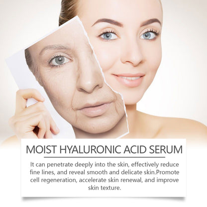 B5 Hyaluronic Acid Essence Lighten Fine Lines Facial Skin Firming, Moisturizing, Moisturizing And Anti-Wrinkle Essence
