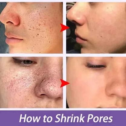 Lactic Acid Pore Minimizing Serum – Korean Skincare for Large Pores