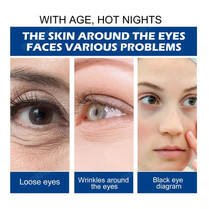 Dark Circles Remover Eye Cream Peptide Anti-Puffiness Eye Bags Wrinkle Cream Skin Care