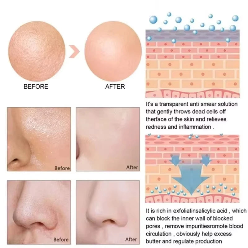 Lactic Acid Pore Minimizing Serum – Korean Skincare for Large Pores