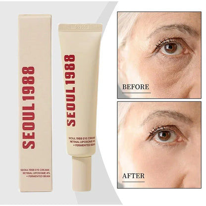 Seoul 1988 4% Retinol Eye Cream – Anti-Aging Eye Treatment for Dark Circles