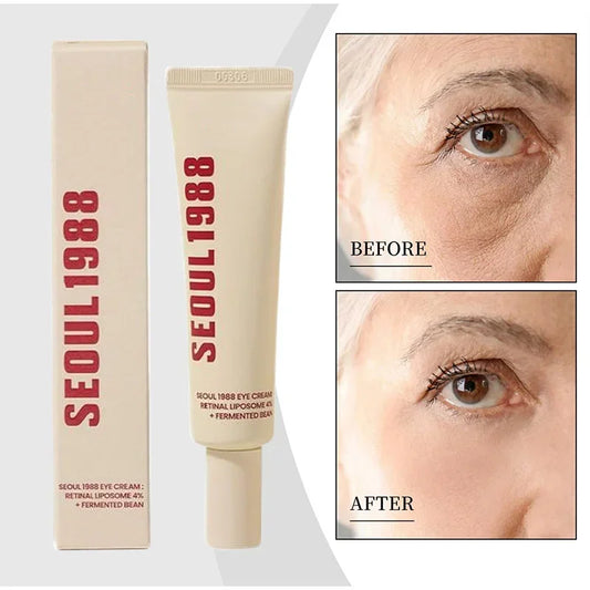 Seoul 1988 4% Retinol Eye Cream – Anti-Aging Eye Treatment for Dark Circles